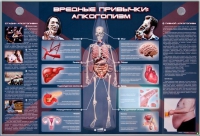 Электрифицированный стенд "Вредные привычки: алкоголизм" - «globural.ru» - Новосибирск