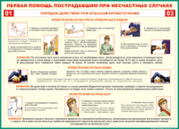 Таблица Порядок действий при опасном кровотечении 1000*1400 винил - «globural.ru» - Новосибирск