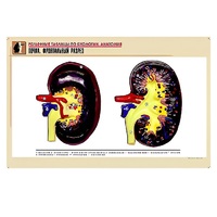 Рельефная таблица "Почка. Фронтальный разрез" (формат А1, матовое ламинир.) - «globural.ru» - Новосибирск
